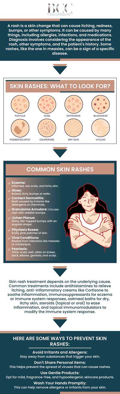 Common questions asked by Clients: Why do I have a rash? What causes rashes? How can I treat a rash? When should I see a doctor for a rash? For more information, contact us or request an appointment online. We serve patients from Miami FL, Key Biscayne FL, Wynwood FL, Coconut Grove FL, South Miami FL, Coral Gables FL, and surrounding areas.