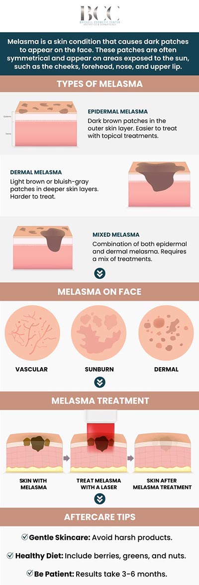 Common questions asked by clients: What is melasma? What causes melasma? How do I know if I have melasma? Is melasma common? For more information, contact us or request an appointment online. We serve patients from Miami FL, Key Biscayne FL, Wynwood FL, Coconut Grove FL, South Miami FL, Coral Gables FL, and surrounding areas.