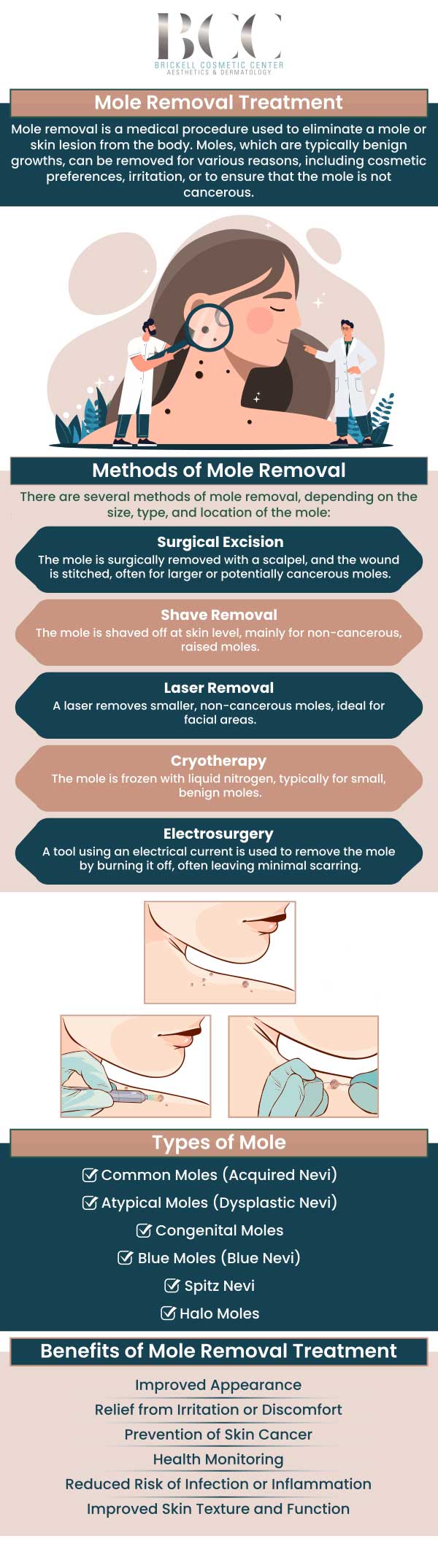 Common questions asked by clients: What is a mole? Are moles common? What causes moles to form? Can moles be removed? For more information, contact us or request an appointment online. We serve patients from Miami FL, Key Biscayne FL, Wynwood FL, Coconut Grove FL, South Miami FL, Coral Gables FL, and surrounding areas.