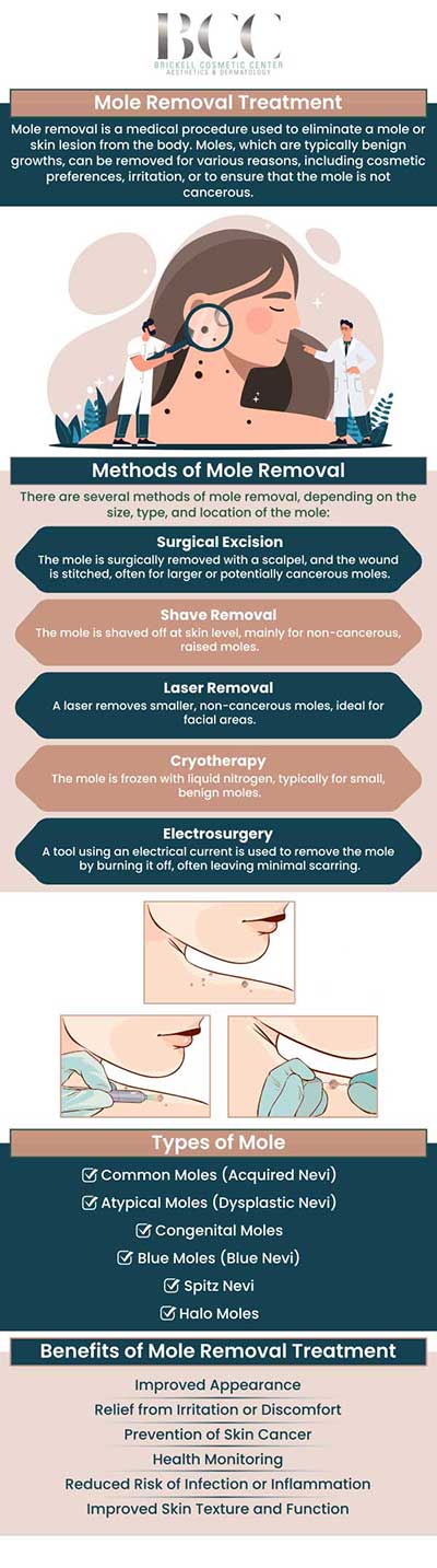 Common questions asked by clients: What is a mole? Are moles common? What causes moles to form? Can moles be removed? For more information, contact us or request an appointment online. We serve patients from Miami FL, Key Biscayne FL, Wynwood FL, Coconut Grove FL, South Miami FL, Coral Gables FL, and surrounding areas.