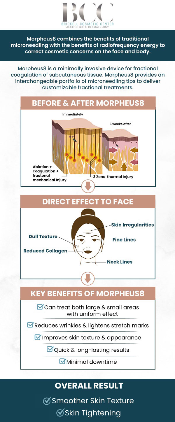 Common questions asked by clients: What is Morpheus8? How does Morpheus8 work? What are the benefits of Morpheus8? Is Morpheus8 safe? For more information, contact us or request an appointment online. We serve patients from Miami FL, Key Biscayne FL, Wynwood FL, Coconut Grove FL, South Miami FL, Coral Gables FL, and surrounding areas.