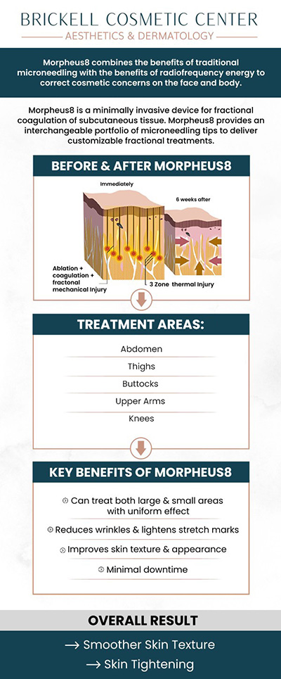 Common questions asked by patients: What is Morpheus8 Body? How does Morpheus8 Body work? What areas of the body can be treated with Morpheus8? How long does a Morpheus8 Body treatment session last? For more information, please contact us or request an appointment online! We are conveniently located at 2730 SW 3rd Ave Ste 100, Miami, FL 33129.
