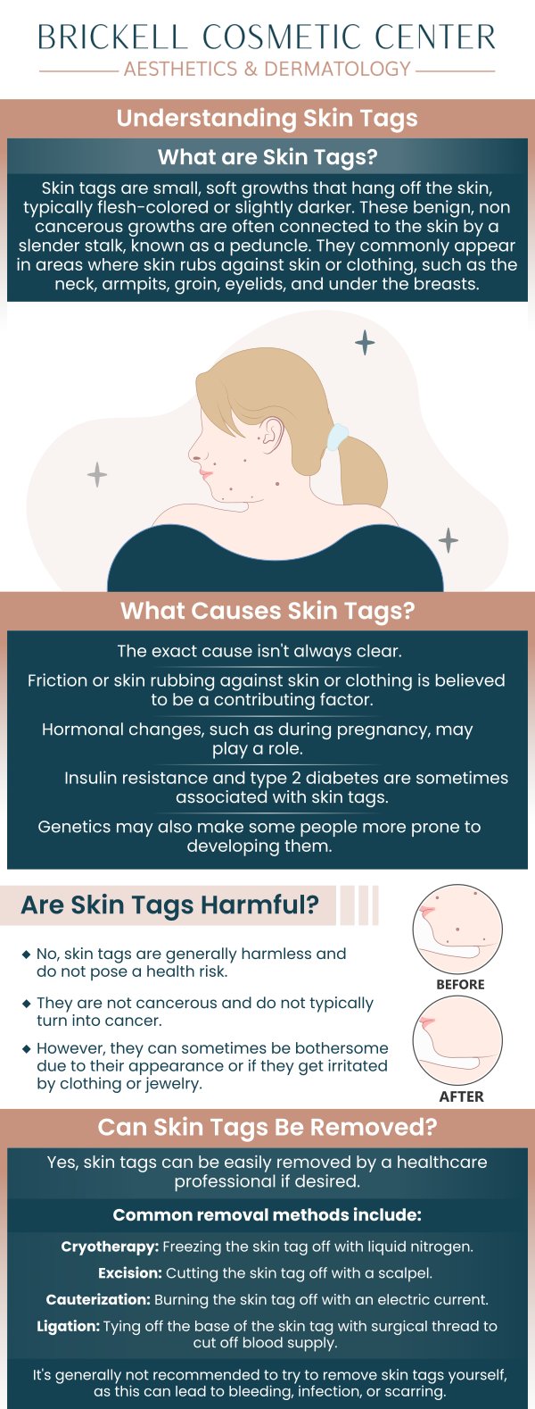 Common questions asked by Clients: What are skin tags? What causes skin tags? Are skin tags harmful? Can skin tags be removed? For more information, contact us or request an appointment online. We serve patients from Miami FL, Key Biscayne FL, Wynwood FL, Coconut Grove FL, South Miami FL, Coral Gables FL, and surrounding areas.