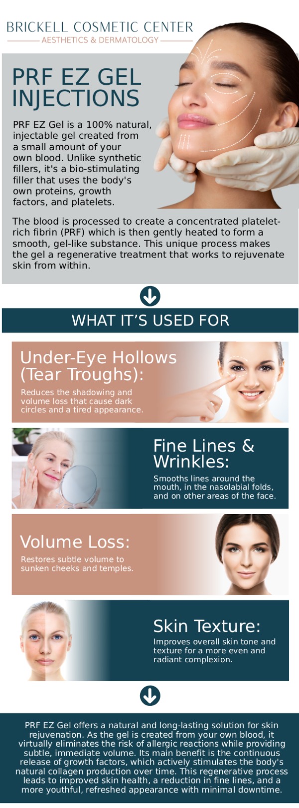Common questions asked by clients: What is EZGel PRF, and how is it made? How long do EZGel PRF injections take? What should I expect during the EZGel PRF procedure? Are EZGel PRF injections safe? Where can I consult an EZGel PRF specialist in Miami, FL? For more information, contact us or request an appointment online. We are conveniently located at 2730 SW 3rd Ave Ste 100, Miami, FL 33129.